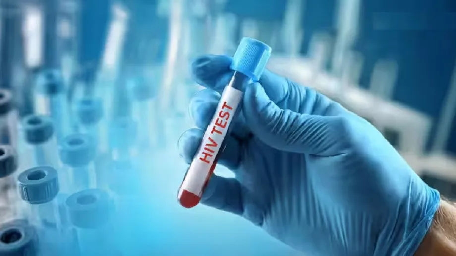 HIV-TEST
