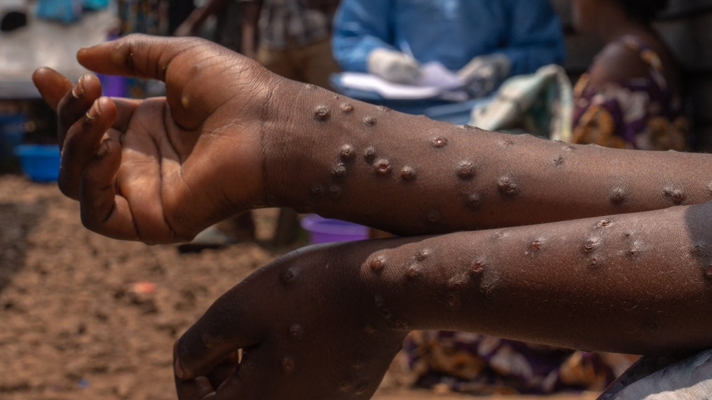 Public Health Beyond the Spotlight — Lessons from Madagascar